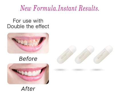 Uwima LED Teeth Whitening Kit